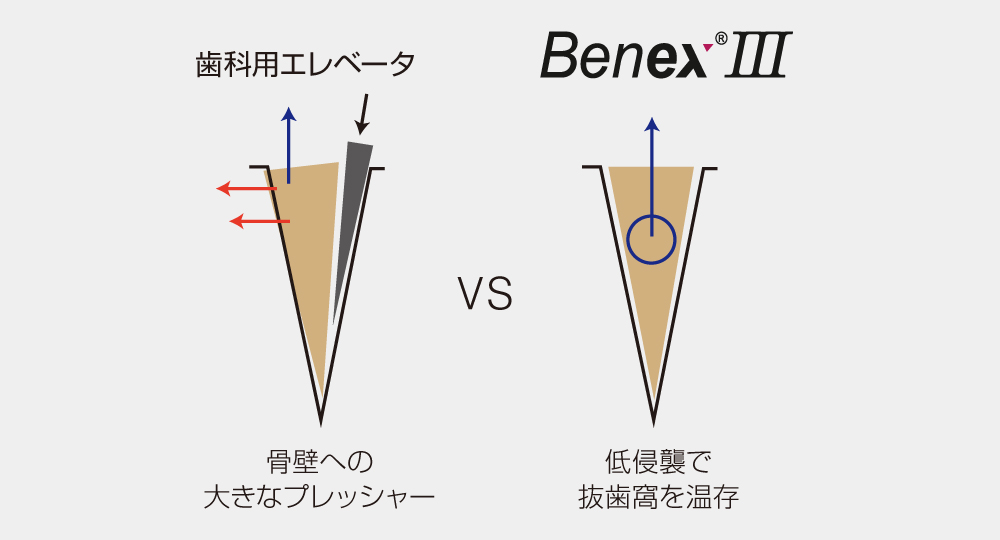 benexiiiの特徴
