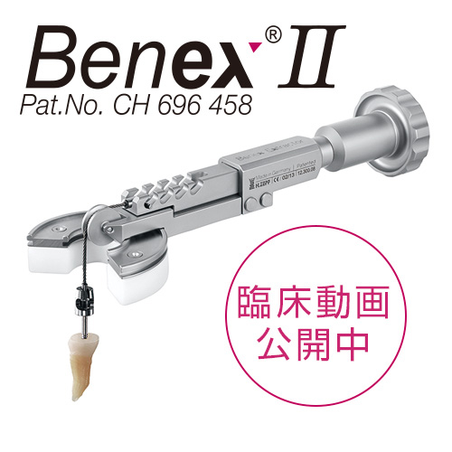 Benex