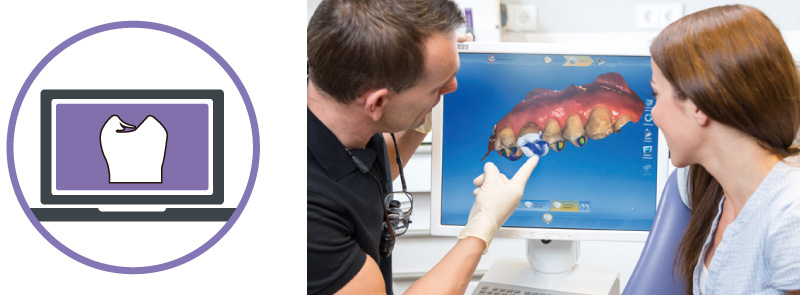 MAZIC Claro CAD 1-Dayトリートメント