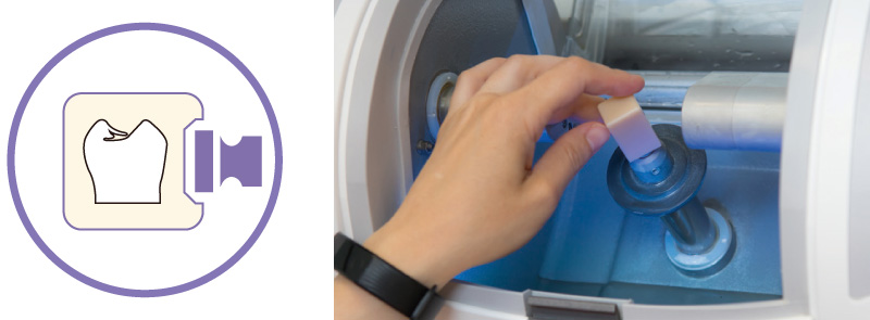 MAZIC Claro CAD 1-Dayトリートメント