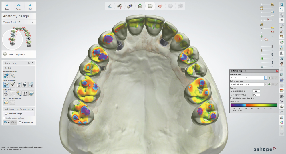 3Shape Dental Systemの特徴:歯科医院と連携したインプラント治療