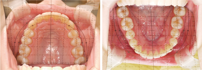 デンタルミラー HAGATAMIの特徴:再現性の高い口腔内写真とスタッフ教育を両立