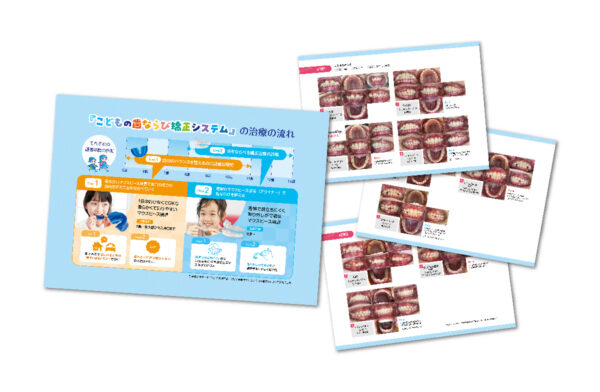 プレオルソとGalaxy Alignのコンビネーション症例