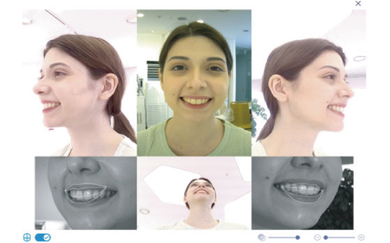 RAYFaceの特徴:高解像度カメラと3D顔認識テクノロジーによる、自然な笑顔の3Dデータ再現